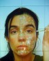 Botox Kunstwerk Botox