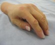 cosmetische prothese Kunstwerk cosmetische prothese