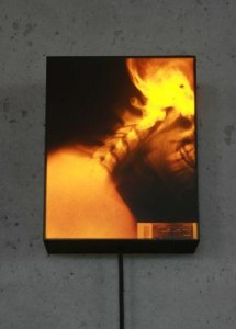 X-Ray Portraits X-Ray Portraits