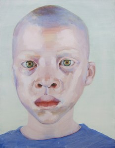 albino  albino