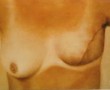 Borst reconstructie 2 Kunstwerk Borst reconstructie 2