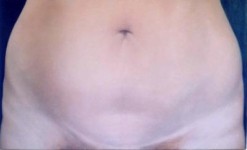 navel navel