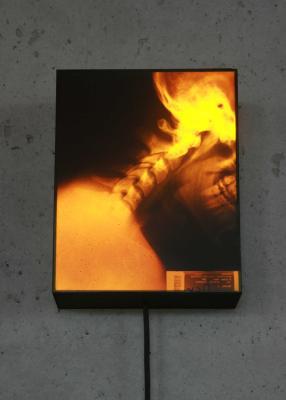 X-Ray Portraits